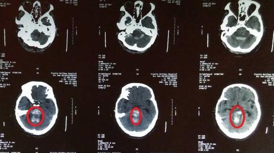 脑在线观看,探索大脑奥秘的数字之旅  第2张